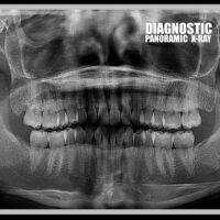 Image of a Diagnostic - Full mouth panoramic x-ray