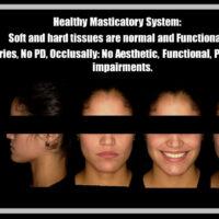 Image of Healthy masticatory system explained