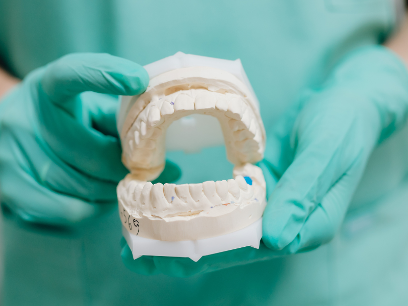 dental-cast-case-study