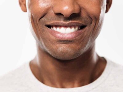 man smiling with a healthy mouth