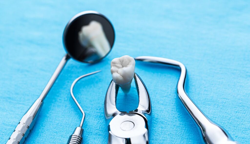 dental extraction - descriptive image